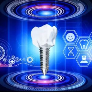 dental implant automation graphic